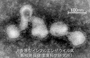A香港型インフルエンザウイルスの電子顕微鏡写真。クリックで拡大