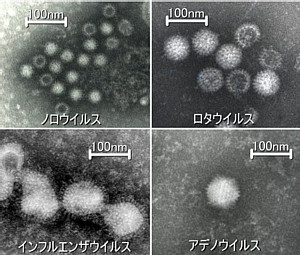 ウイルスの電子顕微鏡写真