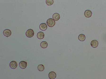 （写真）顕微鏡でみた花粉
