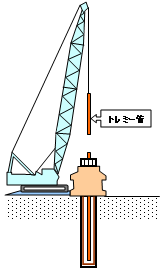 トレミー管挿入のイメージ図