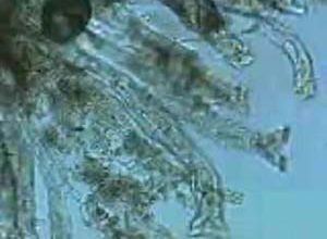 ロタリアの顕微鏡写真です